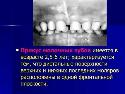 Постоянный прикус