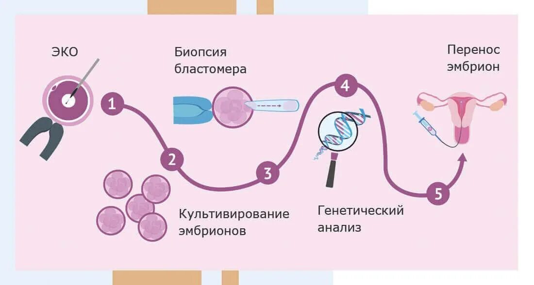 Почему подсаживают. Перенос эмбрионов при эко. Эмбрион при эко. Перенос эмбриона в матку. Экстракорпоральное оплодотворение схема.