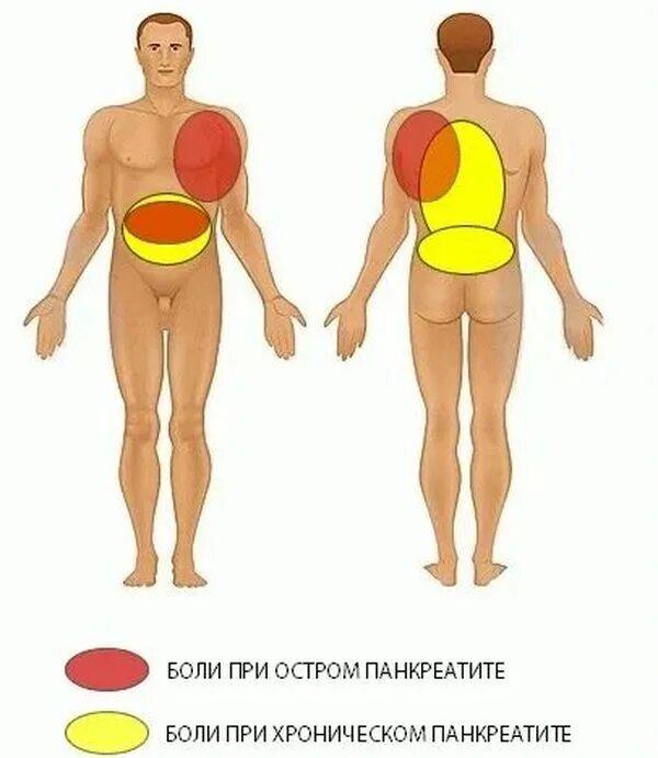 Боле это где. Острый панкреатит локализация боли. Хронический панкреатит локализация боли. Локализация боли при хроническом панкреатите. Острый панкреатит иррадиация.