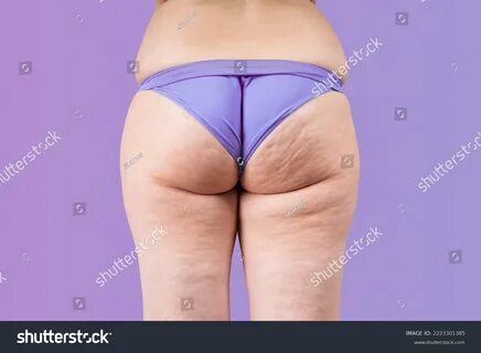 Overweight thigh, woman with fat hips and buttocks