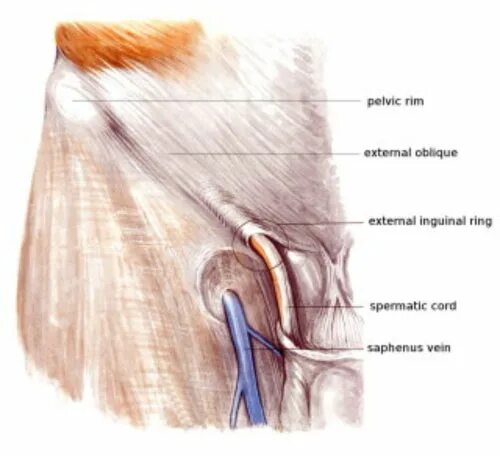 Вена в паху у мужчин. Шишка на Вене в паховой области.