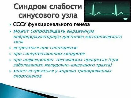 Синдром слабости синусового узла на экг