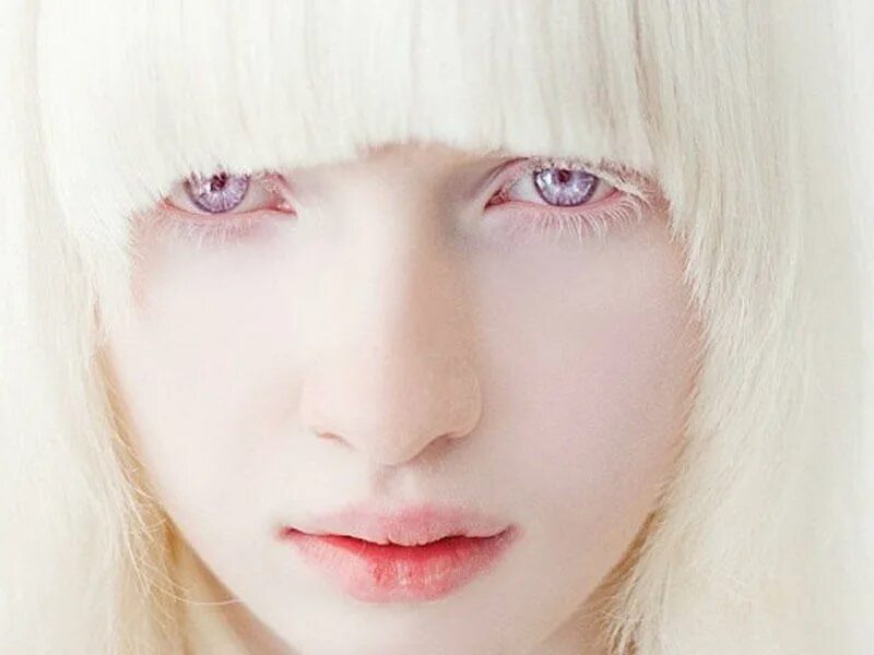 лэйни чэнг альбинос. альбинизм эстетика. альбиносы с фиолетовыми глазами. альбинизм у монголоидной расы. цвет глаз у альбиносов.
