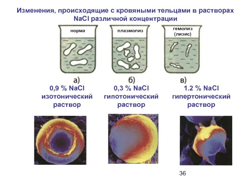 Произошло изменение состояния. Плазмолиз гипотонический раствор. Гипертонический раствор плазмолиз. Лизис и плазмолиз. Плазмолиз и гемолиз.