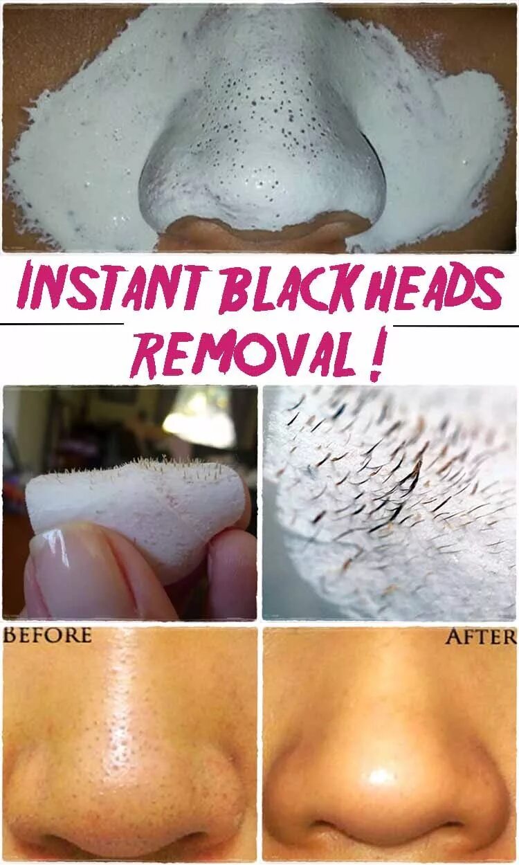 Good Bye Blackhead. Средство Goodbye Blackhead. Goodbye Blackhead способ применения. Blackhead инструкция по применению