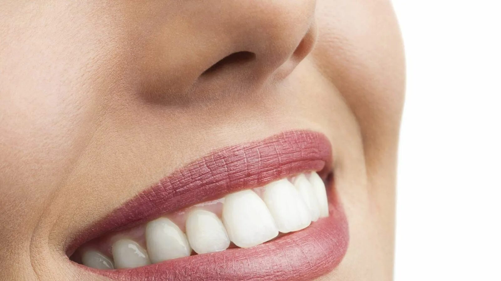 Smile design. Smile design