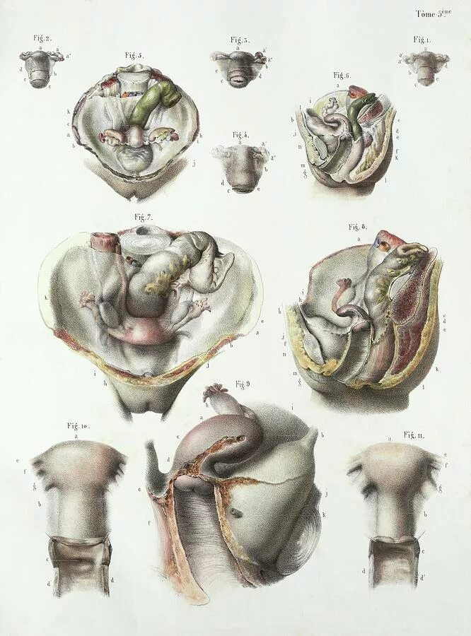 Разновидности женских органов. Гинекология анатомия.