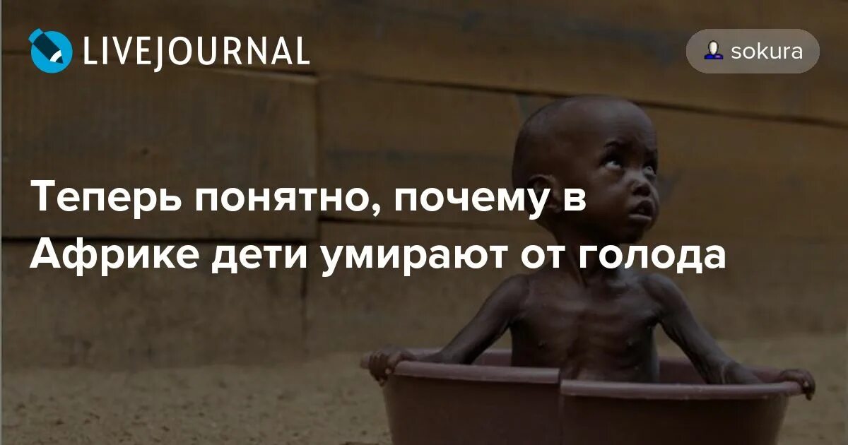 Голод название ему. Голодные африканские дети с раздутыми животами. африканские дети пухнут от голода. в африке у детей животы надутые.