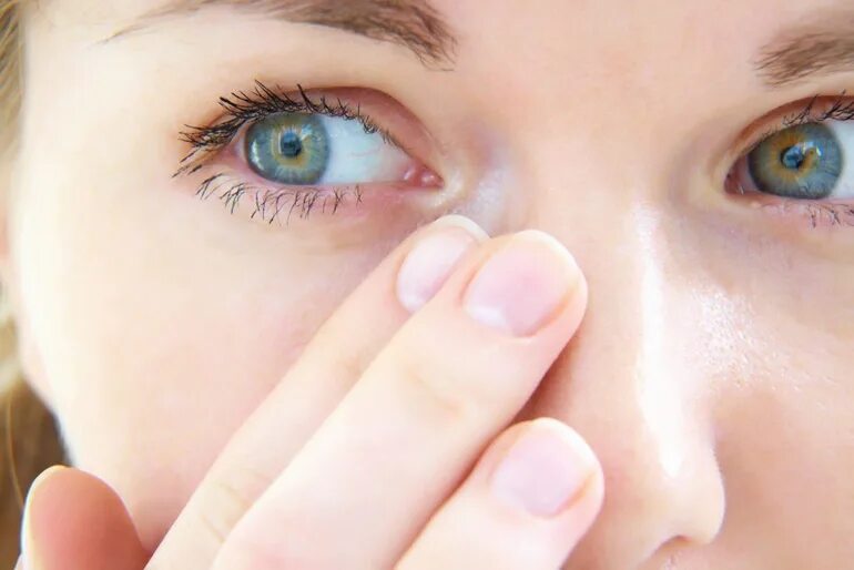 Линзы при сухости глаз. Глаз человека. Аллергические заболевания глаз.