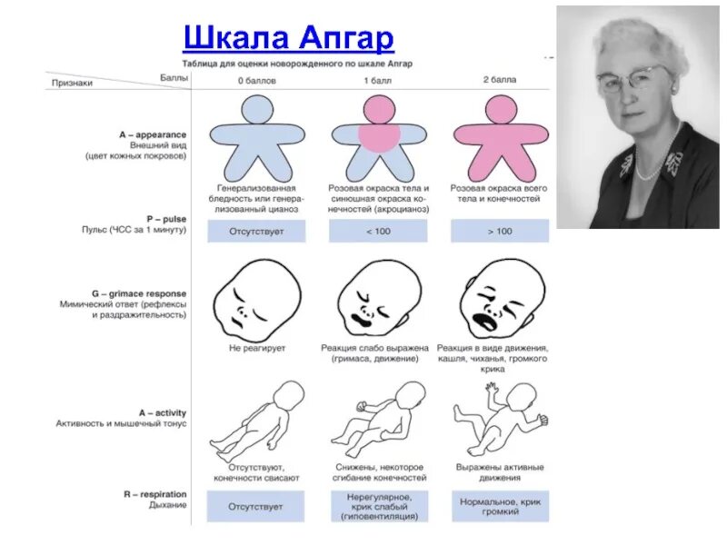 8 8 по апгар после кесарева. Шкала Апгар. Шкала Апгар для новорожденных. Оценка новорожденных по шкале Апгар. Шкала Апгар 9/9.