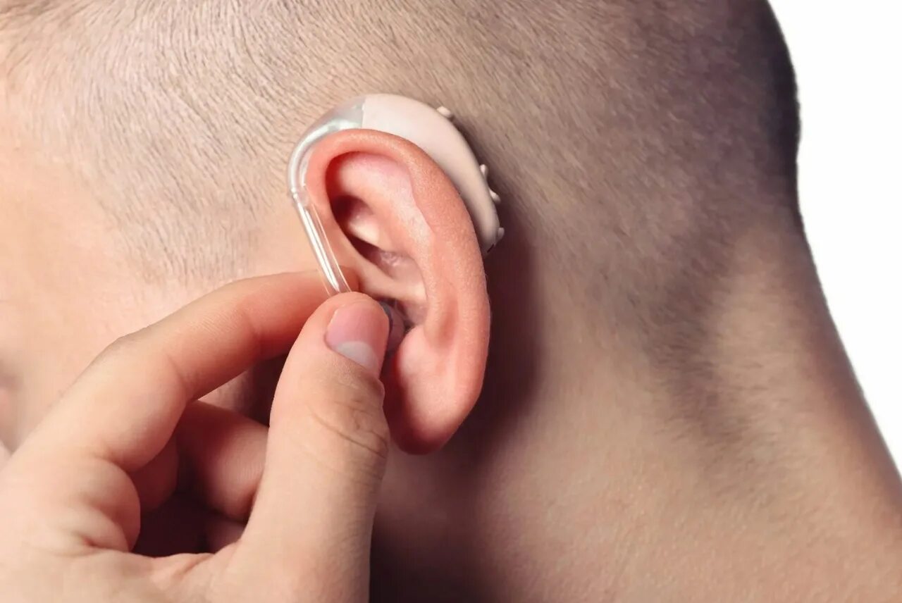 Почему свист в ушах. Заушные слуховые аппараты (BTE). Hearing Aid слуховой аппарат. Ушной протез для слуха.