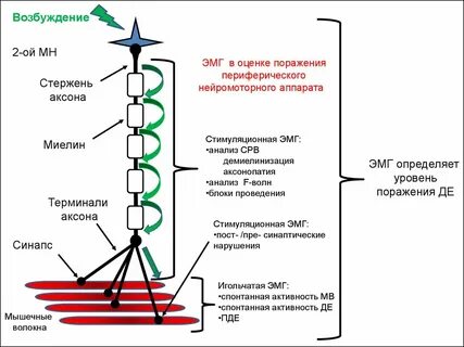 Электромиография принцип метода