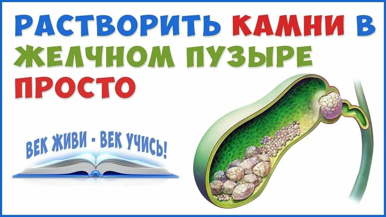 Жкб камни желчного пузыря. Жкб камни желчного пузыря. Растворение камней в желчном пузыре. Желчнокаменная болезнь (холелитиаз). Препараты для растворения желчных камней в желчном пузыре.