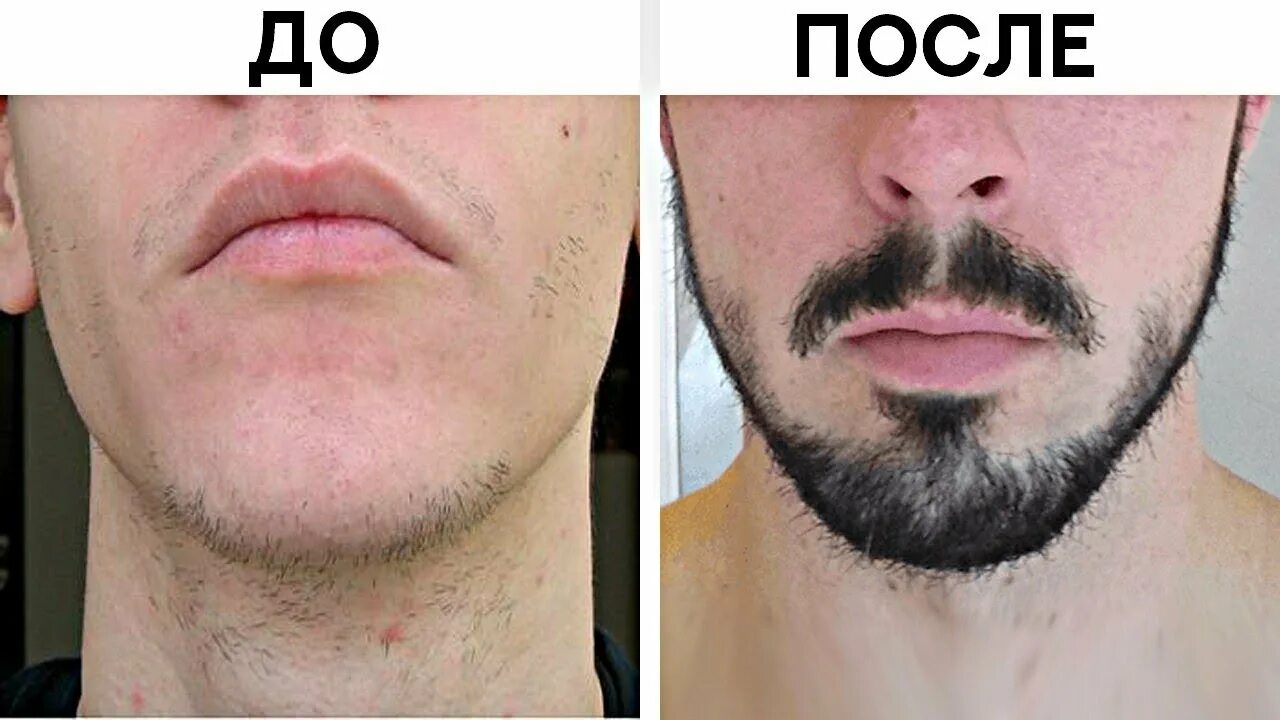 Как сделать чтобы борода росла быстрее