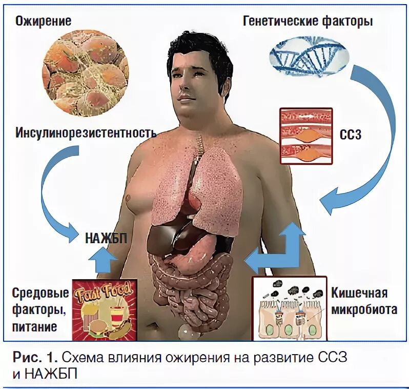 Желчный ожирение