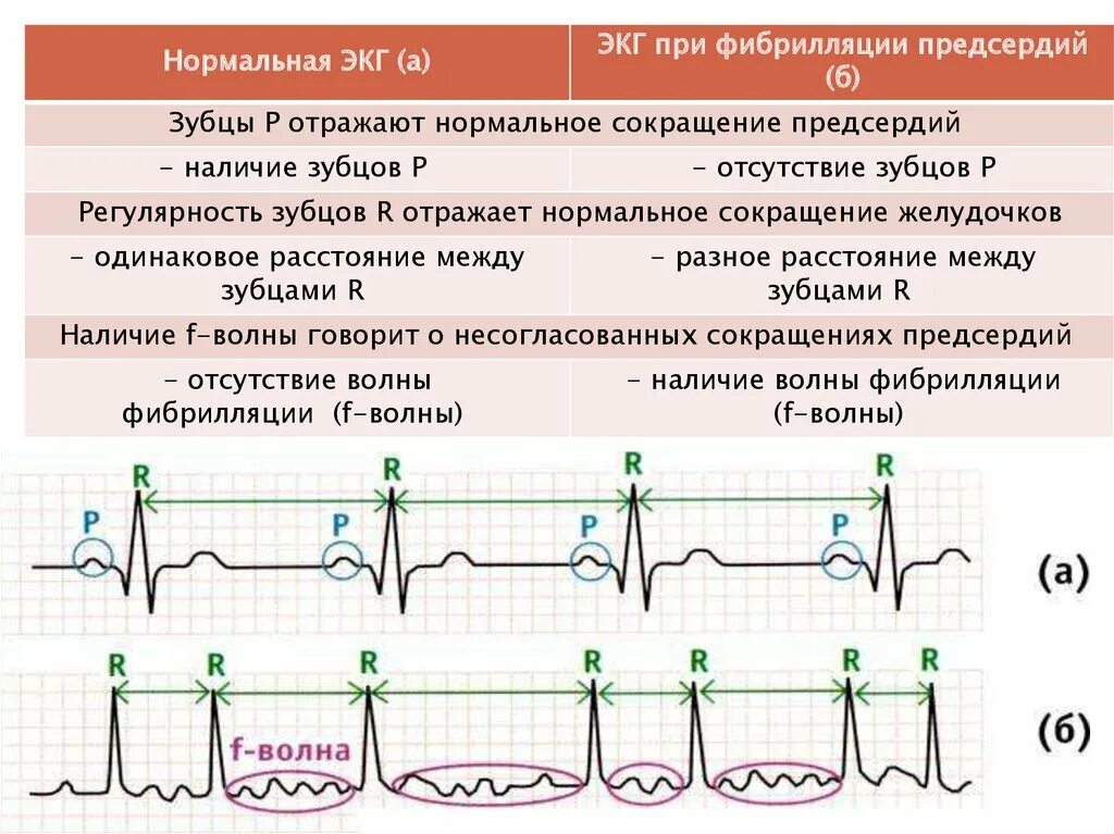 Эхо экг где сделать. Экг на вдохе. экг при вдохе. диагностические показатели экг. интервалы и сегменты экг.