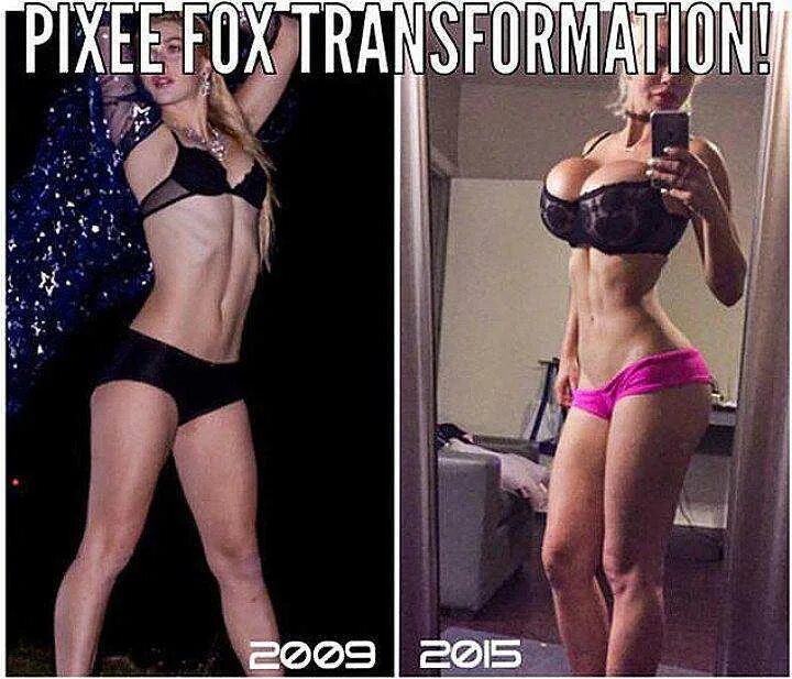 Операция по удалению нижних ребер. Пикси фокс до операции. Зачем удаляют ребра. Фигура после корсета. Уменьшение талии до и после.