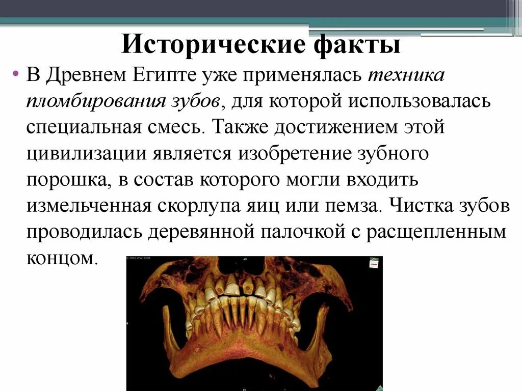 Истории про зубы. Исторические факты. стоматология в древнем египте. интересные истории в стоматологии. стоматология древние египти.