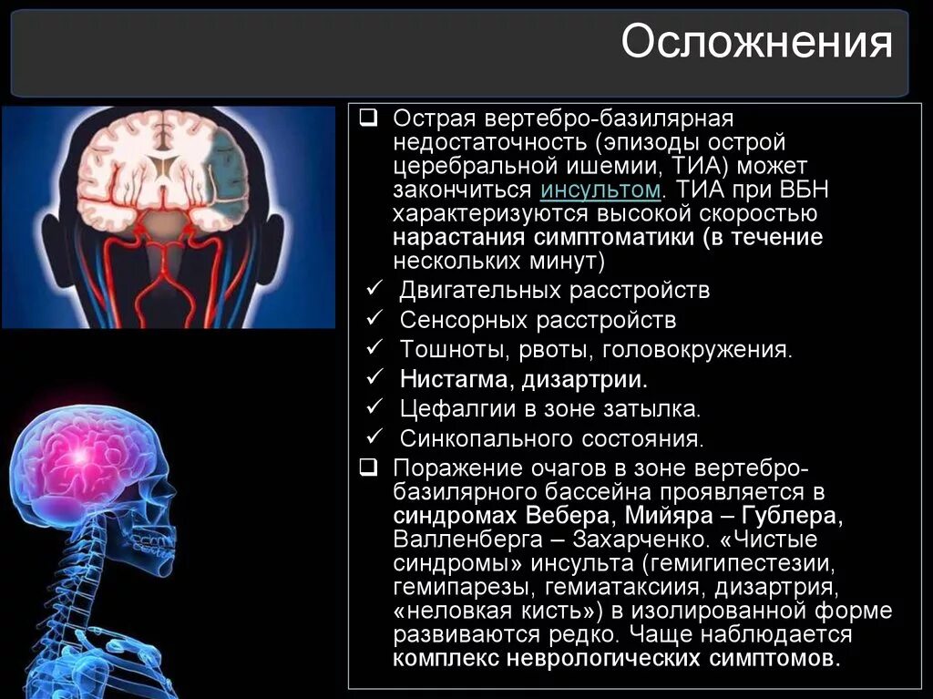 Синдромы поражения каротидного и вертебробазилярного бассейнов. Вертебро-базилярная недостаточность. Синдром вертебробазилярной недостаточности. Синдром вертебробазилярной артериальной системы что это такое.