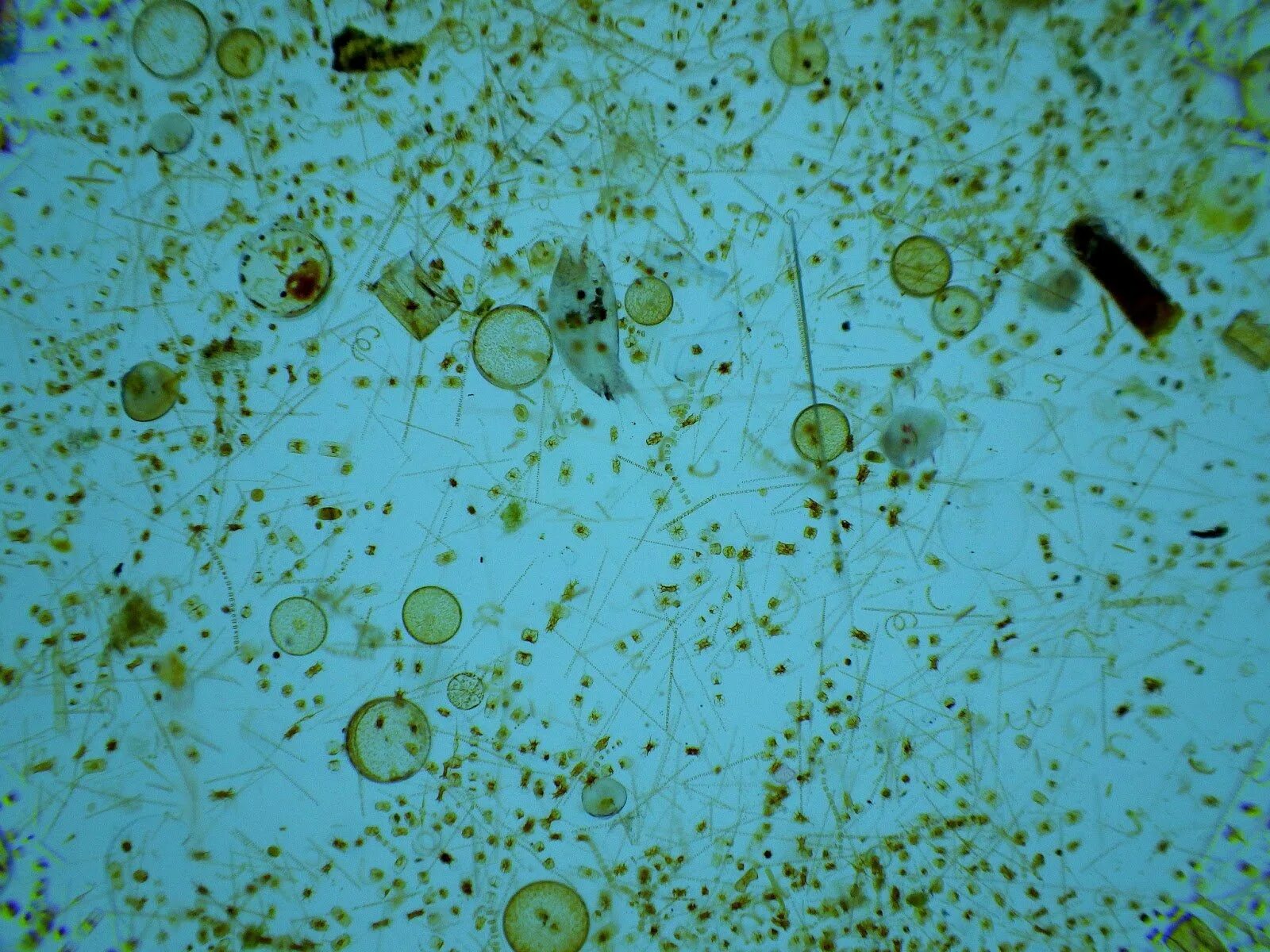 Характеристика фитопланктона. Фитопланктон диатомовые водоросли. Планктонные водоросли фитопланктон. Одноклеточные планктонные водоросли. Синезеленые водоросли фитопланктон.