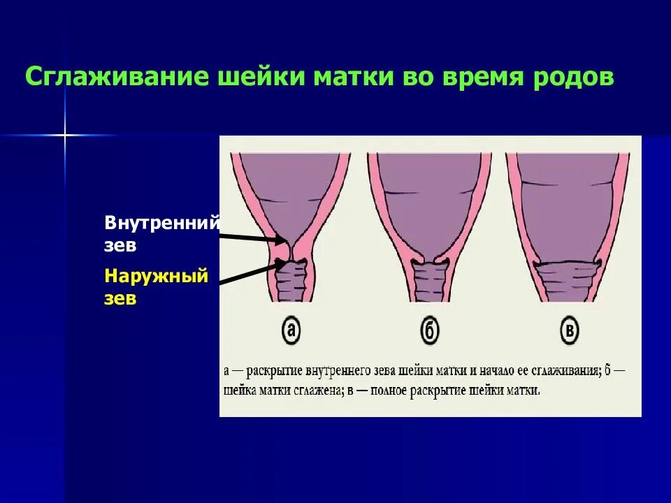 Зев т образный. Шейка матки внутренний зев. внутренний и наружный зев шейки матки. наружный зев шейки матки. шейка внутренний зев сомкнут.