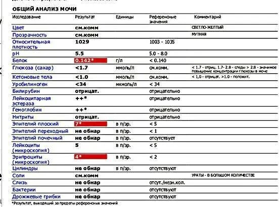 Повышены эритроциты в моче у женщины причины. Лейкоциты в моче мкл норма. норма лейкоцитов в моче в 1 мл. норма лейкоцитов в моче в 1 мкл. уровень лейкоцитов в 1 мл мочи в норме.