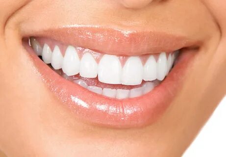 Whitening