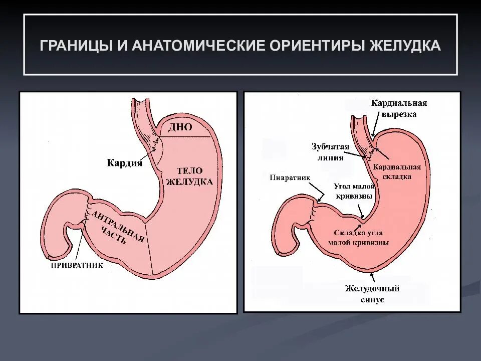 Кардиальный жом желудка. Анатомические ориентиры в желудке. Кардиальная розетка желудка. Недостаток кардии