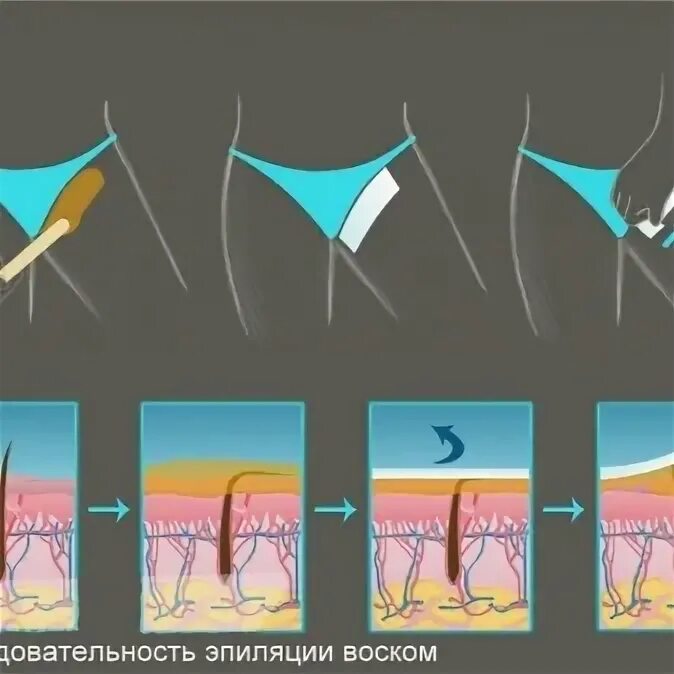 Как побрить интимную зону девушке. Эпиляция воском в зоне бикини. Глубокая депиляция зоны бикини.