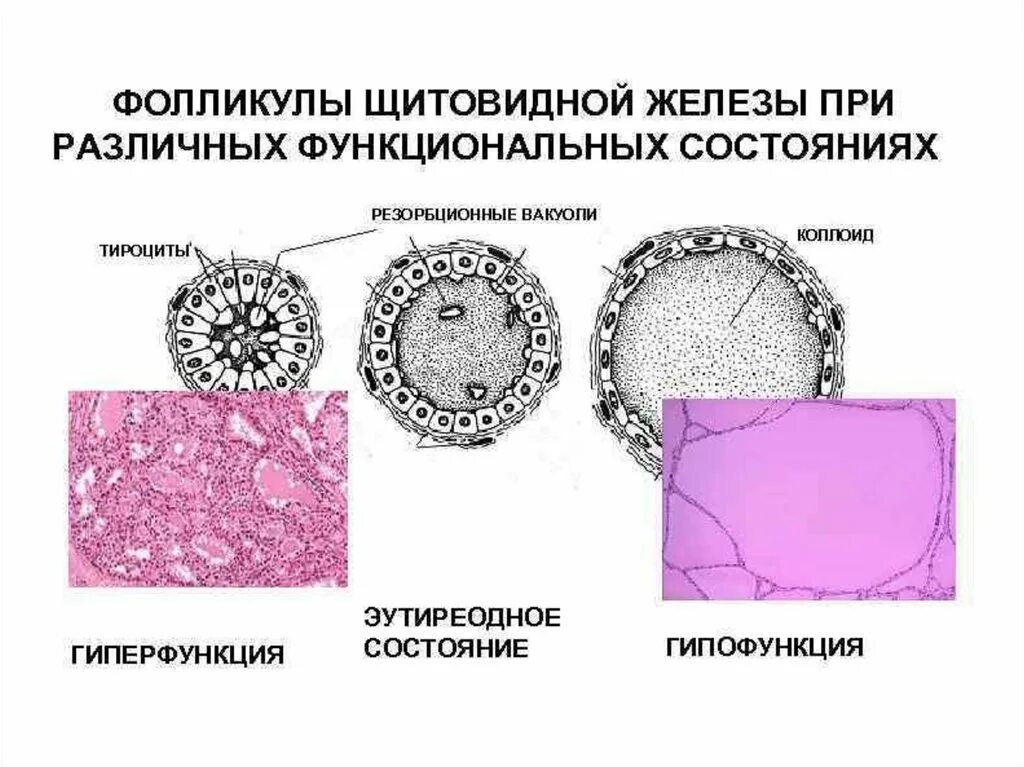 Фолликул щитовидной железы гистология гиперфункция. Фолликул щитовидной железы и тироцит. Схема строения фолликулов щитовидной железы. Строение стенки фолликула щитовидной железы. Фолликул тироцита