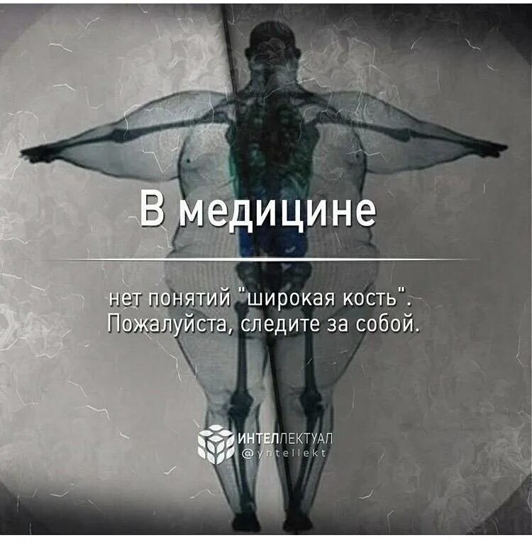 У меня кость широкая. Тяжёлая кость у человека. Бывают ли тяжелые кости у человека. У меня кость тяжелая. Люди с широкой костью.
