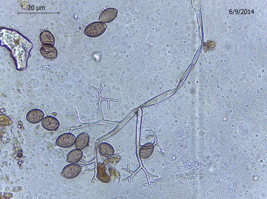 Фитофтора микроскопия. Конидии АНТРАКНОЗА. Септориоз конидии. Alternaria solani спороношение. Споры в кале у взрослого