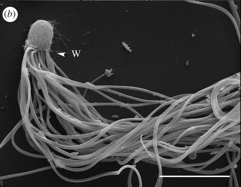 Спермий мха. Электронная микроскопия сперматозоидов. Сперматозоид микрофотография. Срерматозойд под микроск. Сперматозоид под микроскопом.