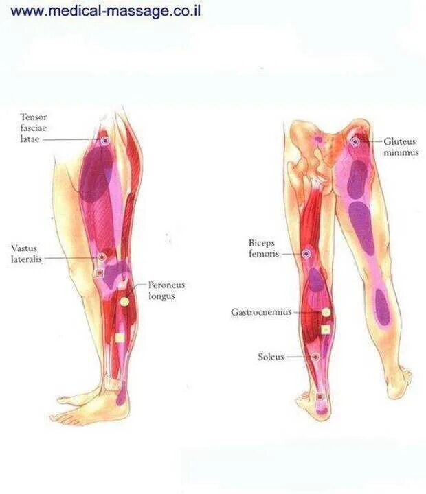 Мышцы стопы миофасциальные триггерные точки. Триггерные точки прямой мышцы бедра. Триггерные точки мышц стопы. Остеопатия триггерные точки.