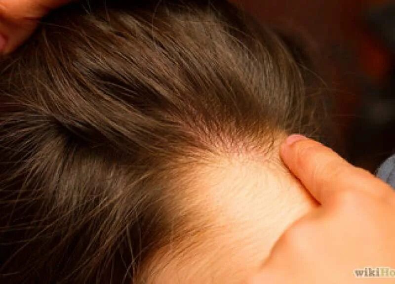 Зуд от вшей. Поправляет волосы. Зуд от вшей. Зуд от вшей. Зуд от вшей.