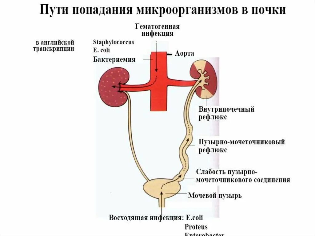 Хронический цистит пиелонефрит. Острый пиелонефрит».пути инфицирования почек. Гематогенный путь проникновения инфекции в почки. Пути попадания инфекции при пиелонефрите. Гематогенный нисходящий пиелонефрит.