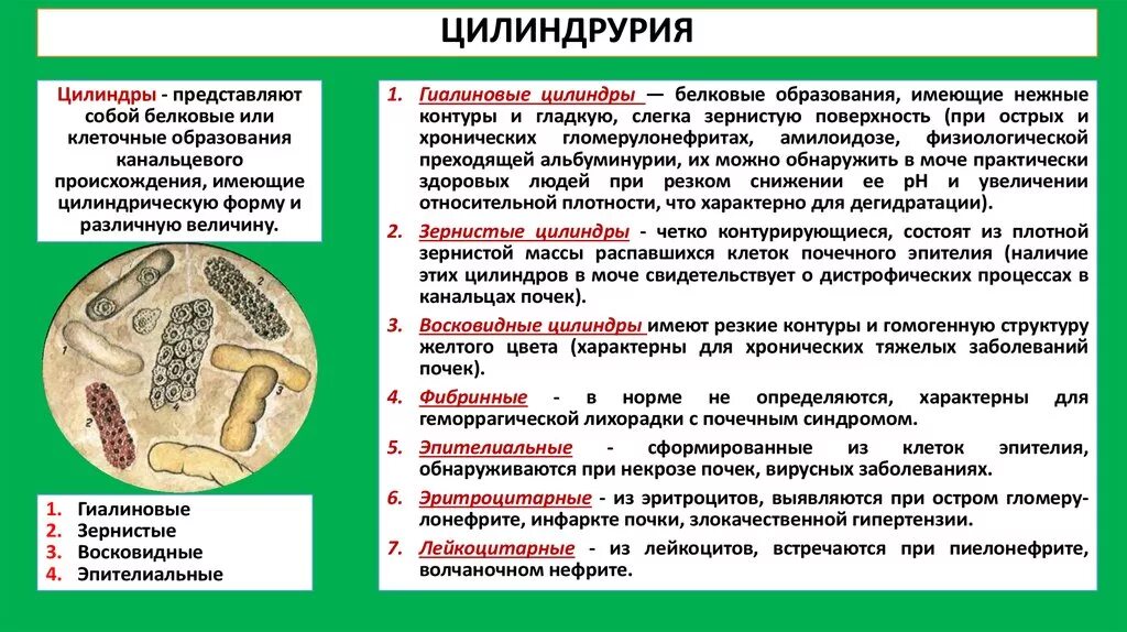 Повышенные цилиндры в моче. Гиалиновые цилиндры в моче. Цилиндрурия в моче. Цилиндры в моче цилиндрурия. Протеинурия гиалиновые цилиндры.