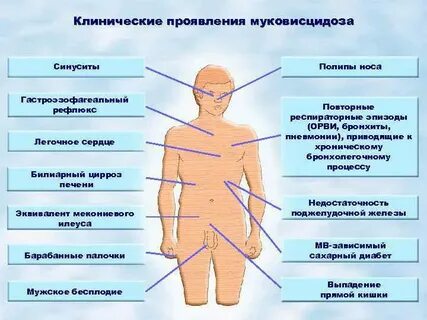 Клинические особенности муковисцидоза у детей старшего возраста
