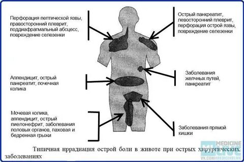 Боли при панкреатите где болит