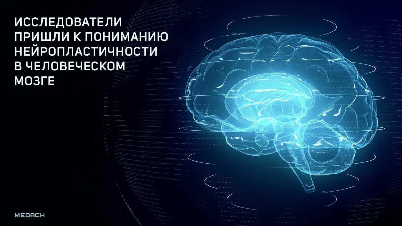 Нейропластичность мозга. Гибкость мозга. Принципы нейропластичности мозга. Безграничные возможности мозга. Пластичный мозг