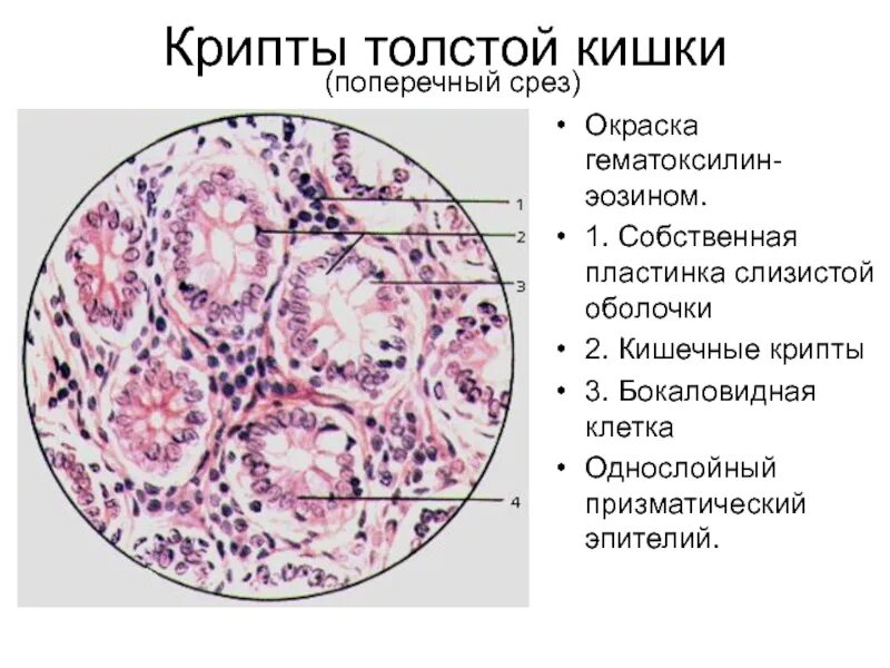 Крипты клетки. Крипты толстой кишки гистология. крипты толстого кишечника гистология. слизистая оболочка толстой кишки. окраска гематоксилином и эозином. поперечный срез тонкой кишки гистология.