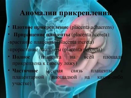 Аномалии плаценты
