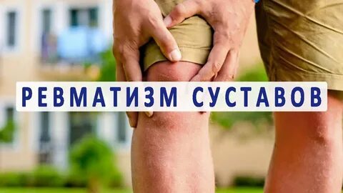 Ревматизм суставов симптомы у женщин после 50