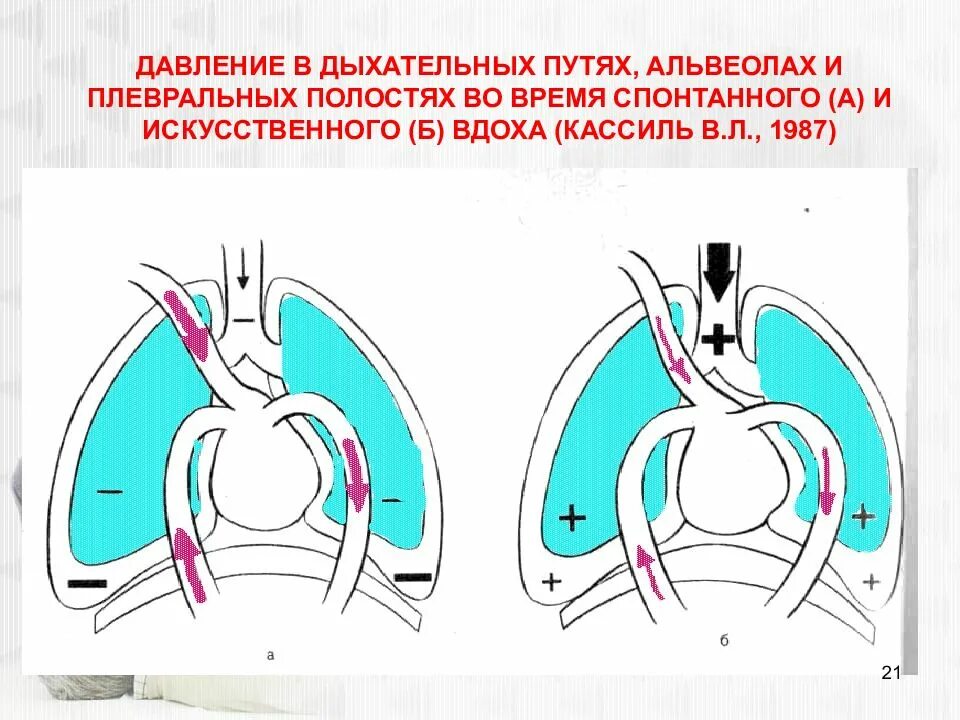 Давление в дыхательных путях. Давление в плевральной полости. Пиковое давление в дыхательных путях ИВЛ. Пиковое давление в дыхательных путях норма.