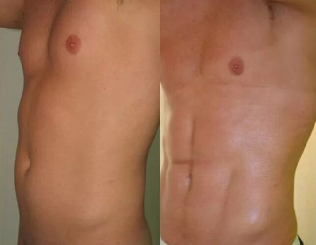 небольшой живот у мужчин. маленький живот мужчины. маленький живот мужчины. маленький живот мужчины. мужской живот.