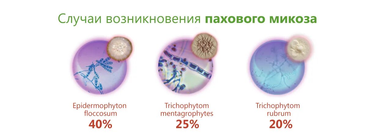 Эритразма у мужчин: опытный венеролог в Москве.