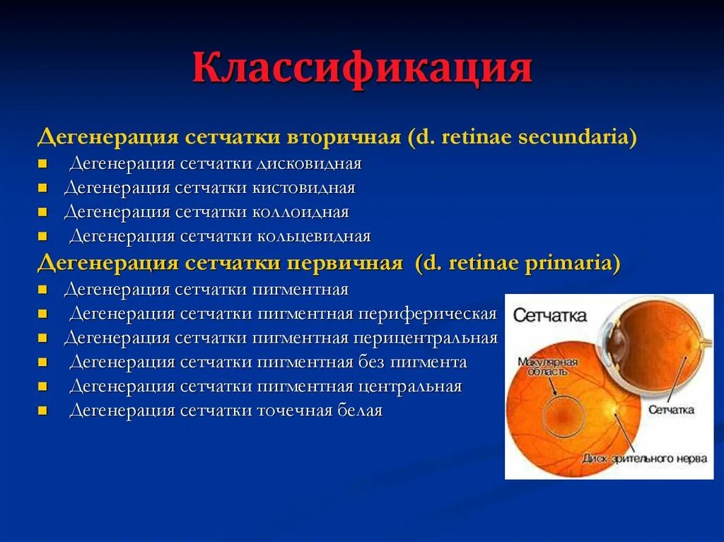 Периферические ретинальные дегенерации. Пигментные дистрофии сетчатки классификация. Заболевания сетчатки классификация. Классификация заболеваний сетчатой оболочки. Заболевания сетчатки глаза классификация.