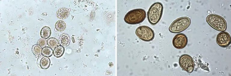Микроскопия кала яйца гельминтов. Яйца аскариды под микроскопом. Неоплодотворенное яйцо аскариды. Простейшие в кале лечение