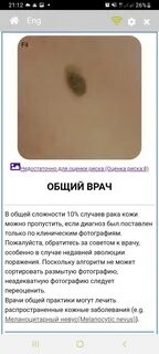 Родинка краткое содержание