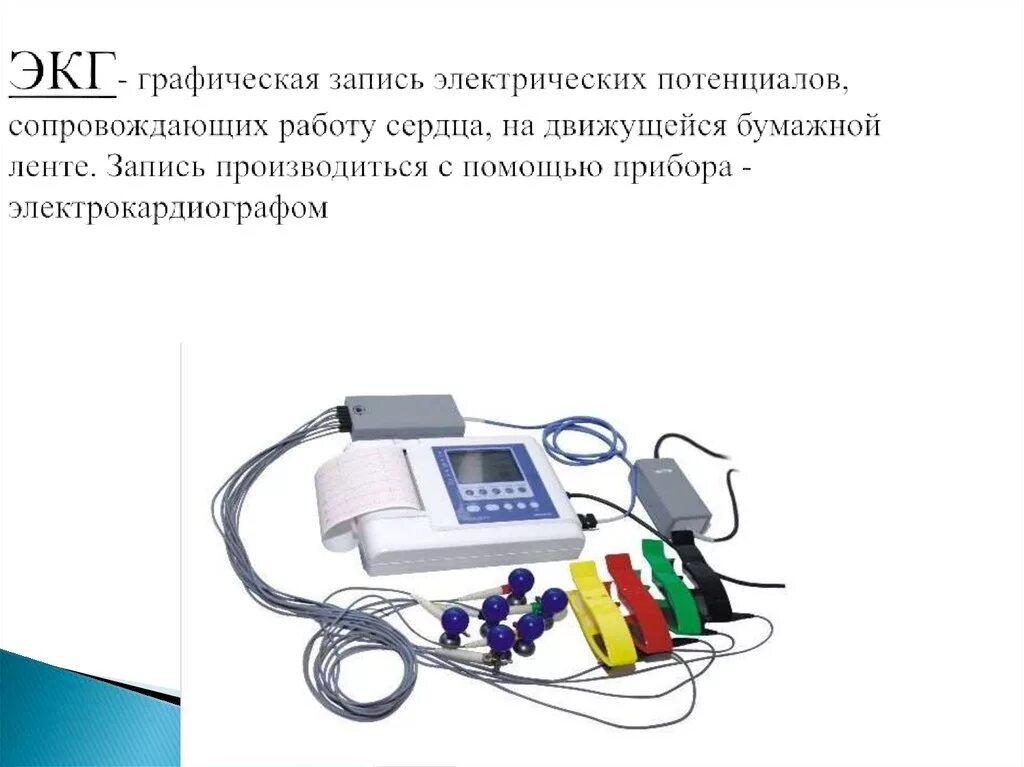 ЭКГ аппарат техника записи. Методы снятия ЭКГ. ЭКГ строение аппарата. Схема подключения электрокардиограммы. Платные услуги экг